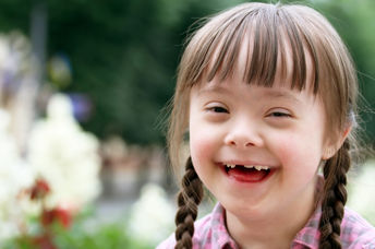 Beautiful child with Downs Syndrome.