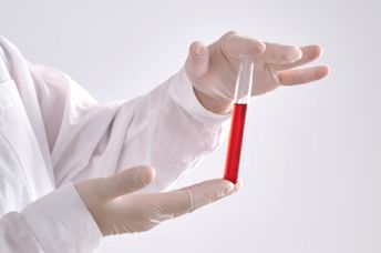 A new blood test detects Alzheimer's earlier.