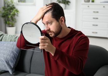A man with hair loss.