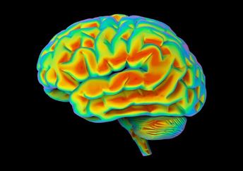 3D medical view of the human brain.