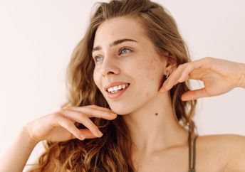 A woman with no makeup and red spots on her face.