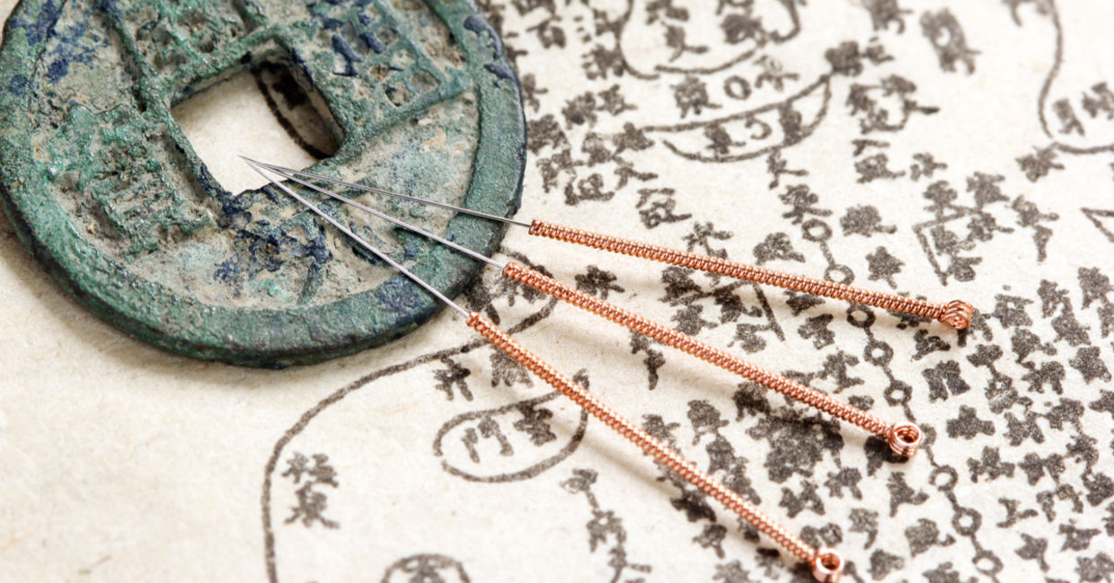 Acupuncture is an ancient treatment for pain.