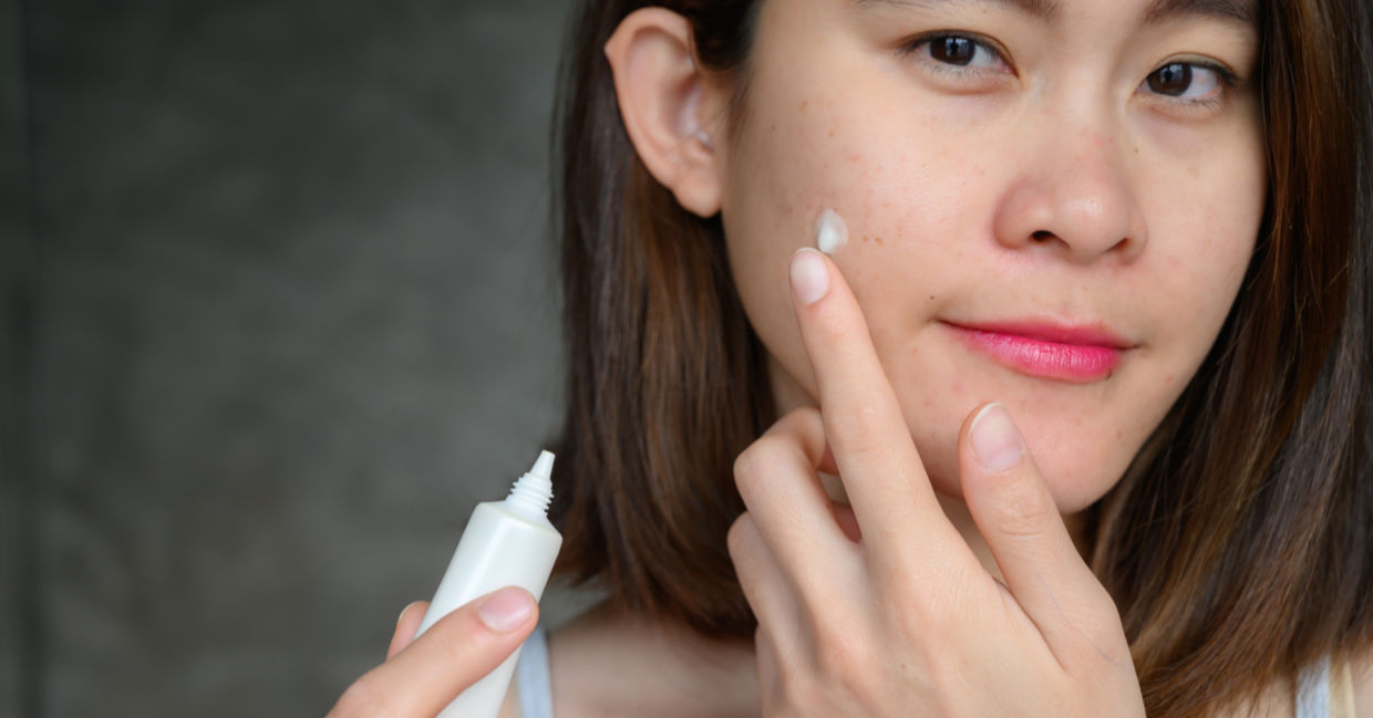 Treating a breakout with a tea tree oil cream.