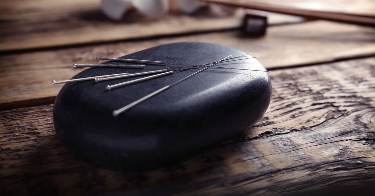 Acupuncture needles could help with allergy relief.