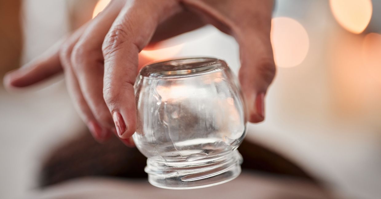 Cupping is a Traditional Chinese Medicine practice.