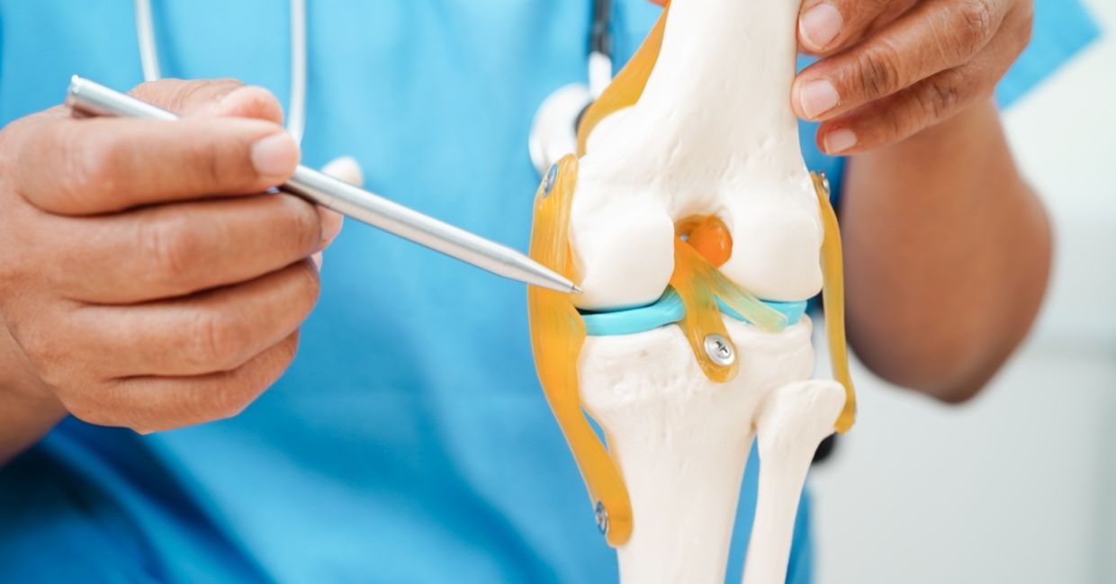 Model of a knee with osteoarthritis.